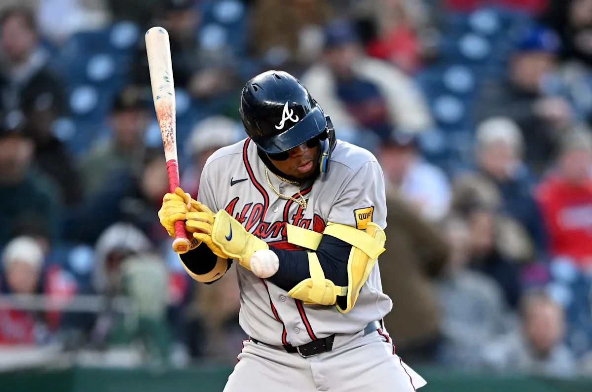 Braves All-Star Ronald Acuña Jr. leaves game after Vacated hand hit by pitch